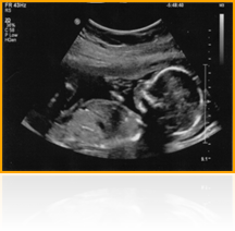 Suvidha Hospital Reception